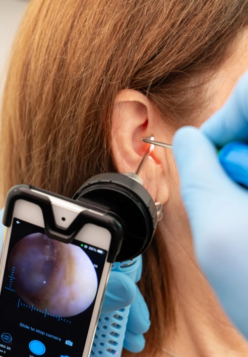 Otoscope with smartphone screen examines ear during an ear cleaning procedure by a specialist wearing blue gloves.