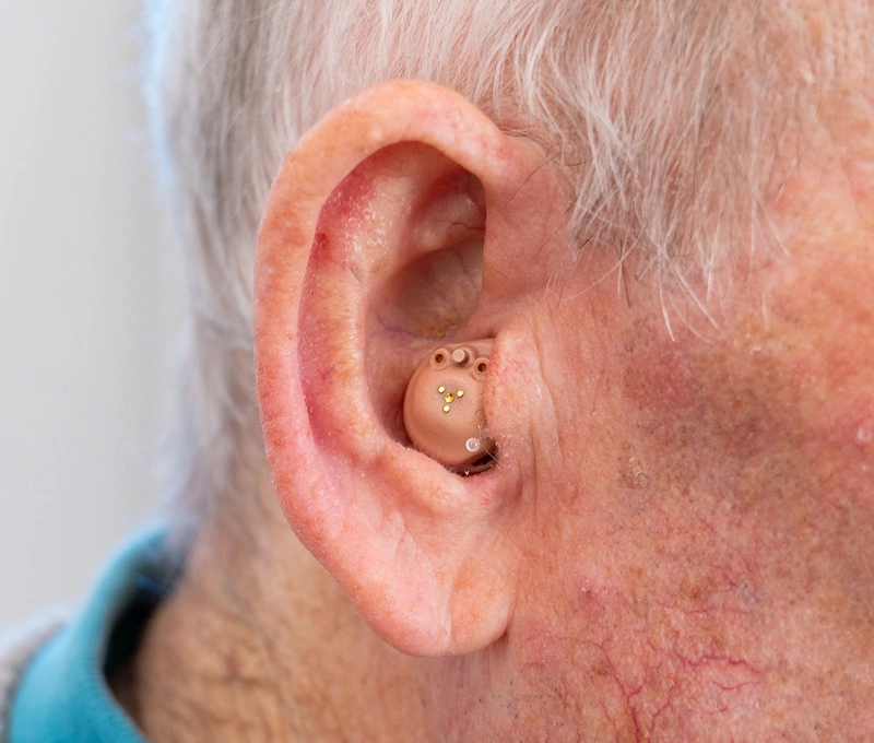 Close-up of an ear with a discreet hearing aid inserted for improved auditory assistance.