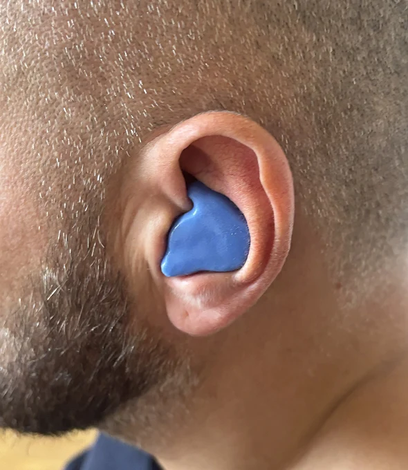 Close-up of a person wearing a blue custom earplug in their left ear for noise protection.