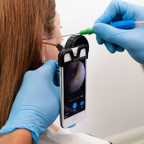Smartphone with otoscope attachment used for ear examination, close-up view of screen and ear canal.