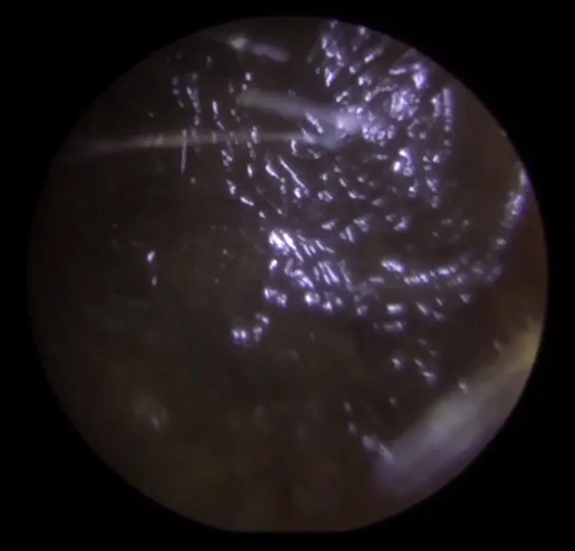 Close-up view of a scorpion under a microscope, highlighting its intricate details and texture.