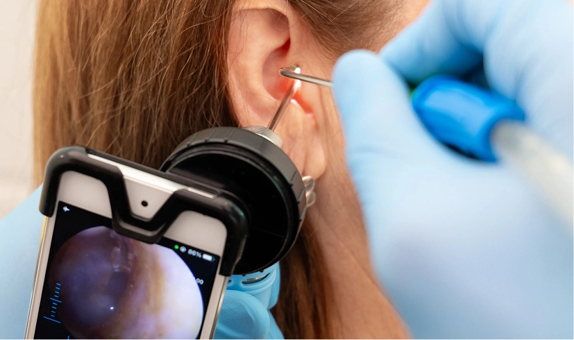 Ear examination using modern otoscope with smartphone screen display.