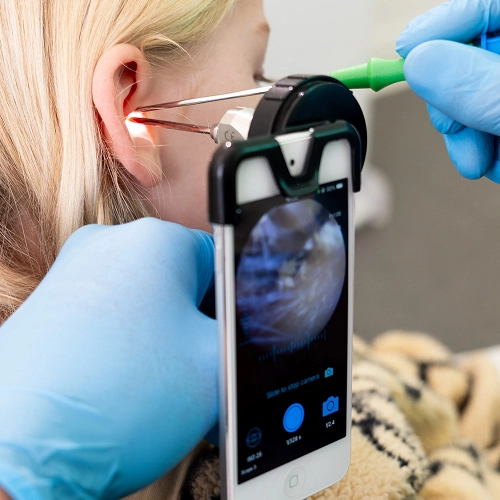 Ear examination with smartphone otoscope, highlighting modern medical technology in healthcare diagnostics.