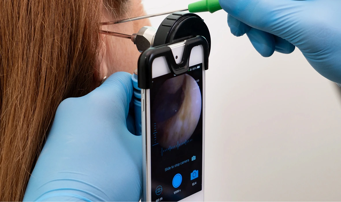 Doctor using smartphone otoscope to examine a patient's ear canal, showing detailed inner ear view on screen.