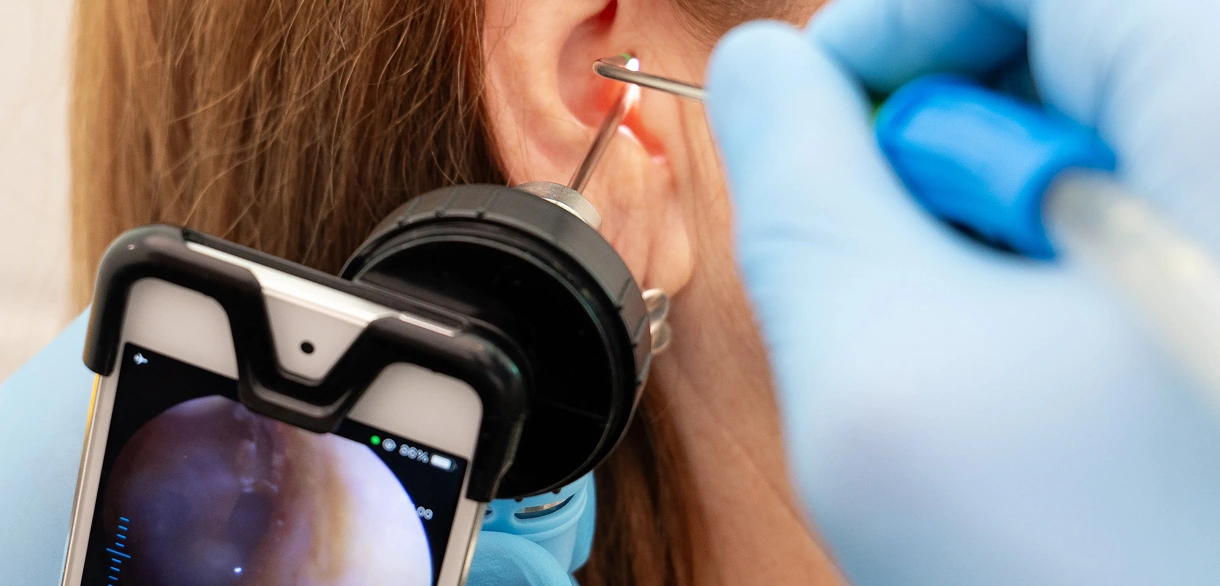 Earwax removal with an endoscope and smartphone display, guided by a gloved professional for precise cleaning.