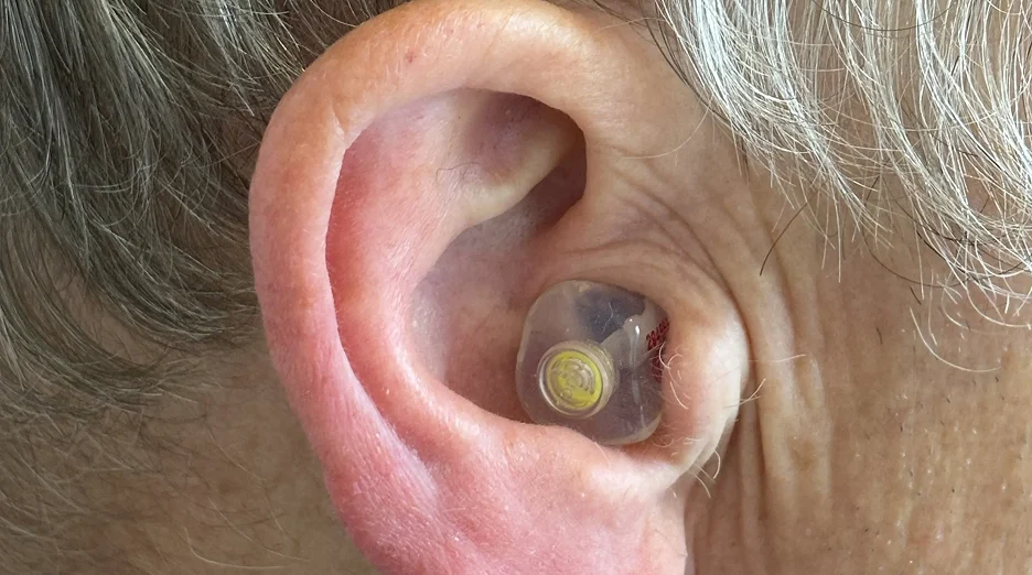 Close-up of an ear with a small transparent hearing aid device inserted for discreet hearing assistance.