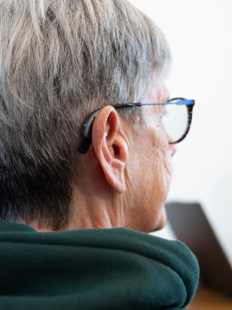 receiver in canal hearing aid worn by patient’