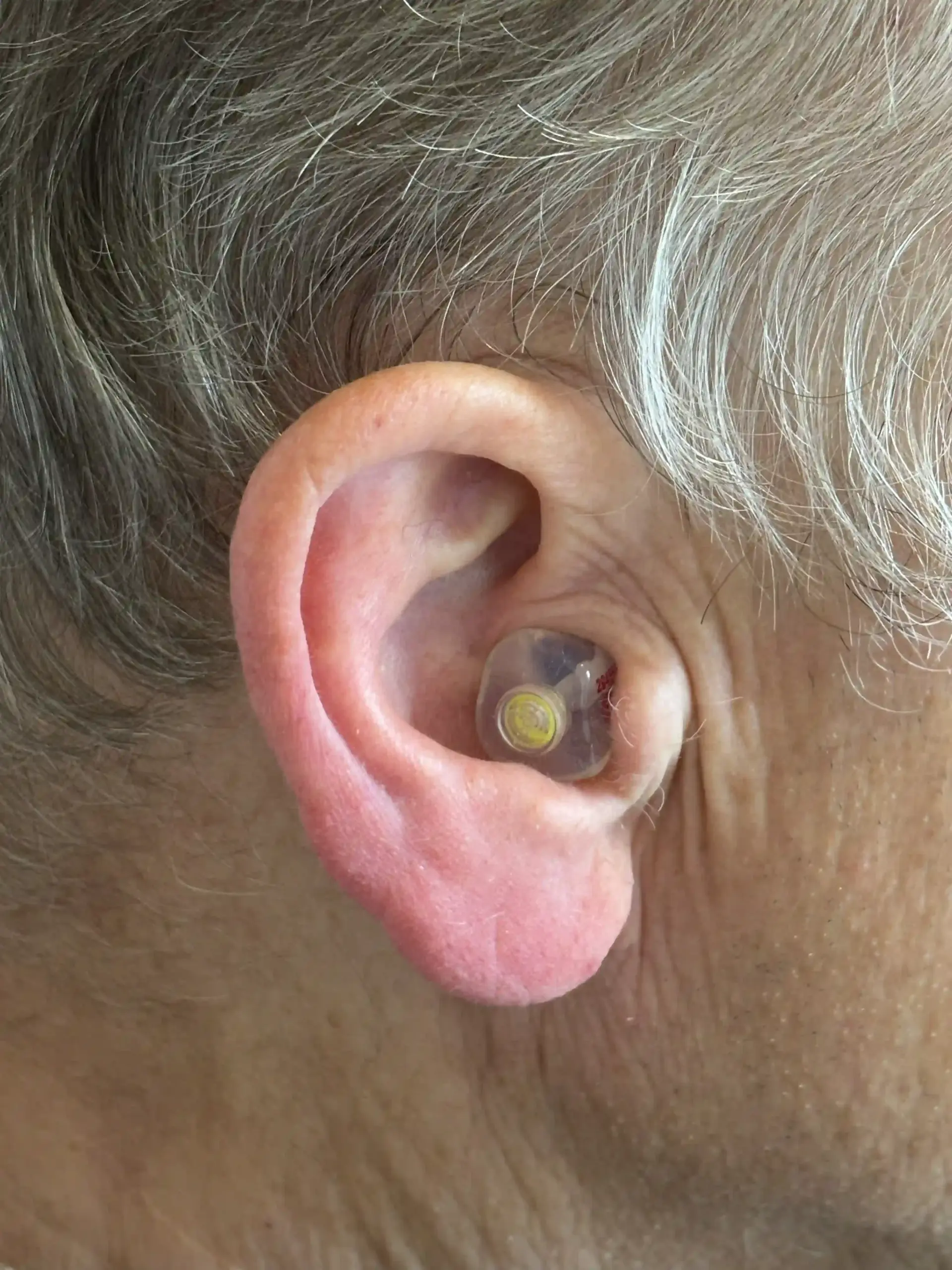 Person wearing a clear custom in-ear hearing device fitted inside the ear.